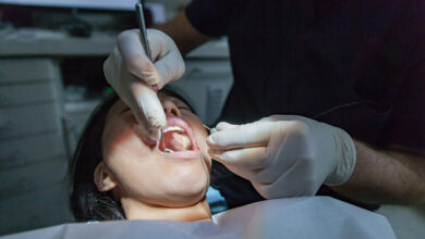 Emergency Tooth Extraction