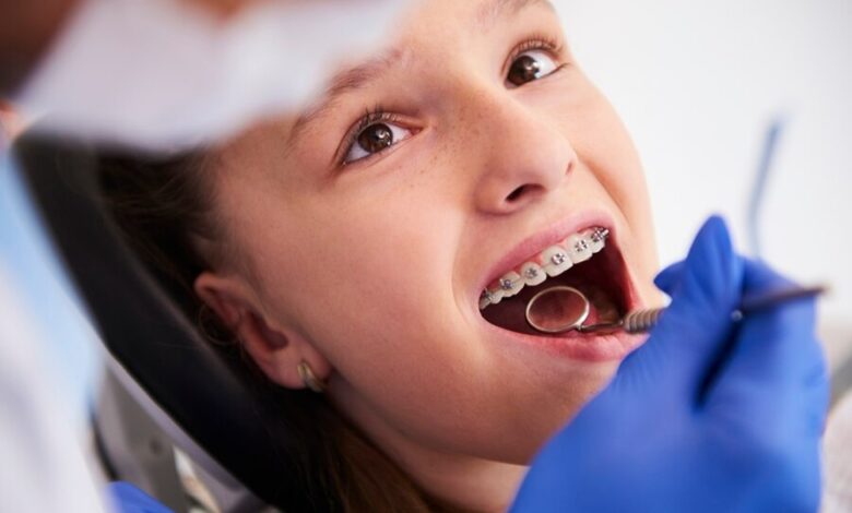 Orthodontic Treatment