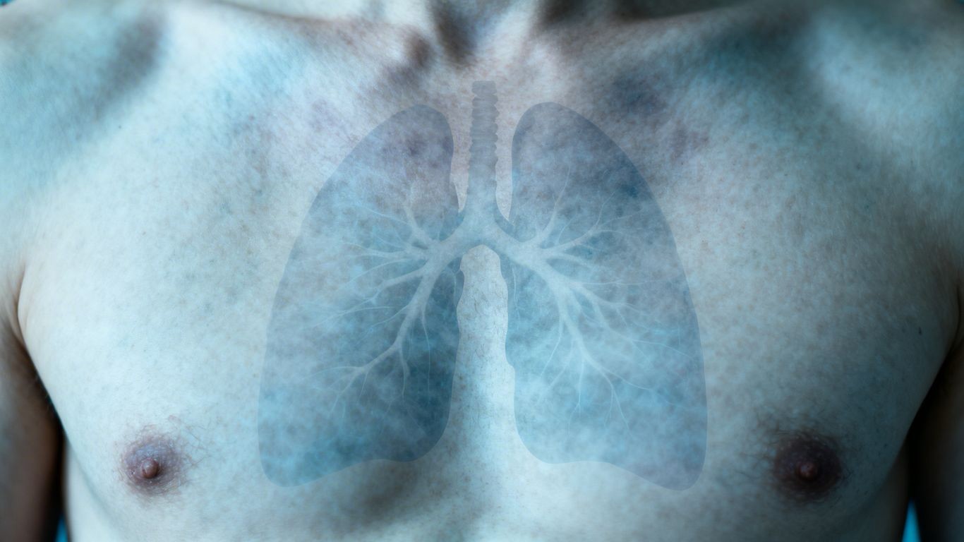 The Latency Period Of Asbestos Cancer Symptoms