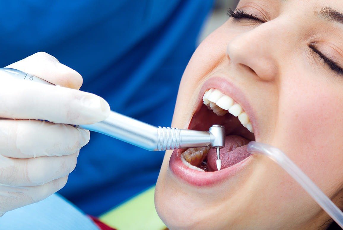 Integrated Dental Care: The Benefits of Accessing Root Canal Treatment Within the Infrastructure of Hospitals in the UAE