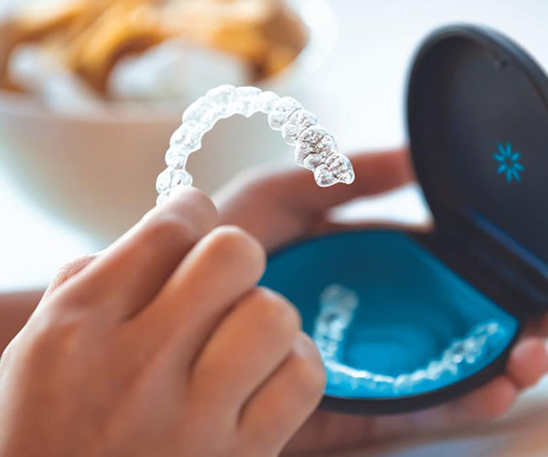 Invisalign for Adults: The 2026 Process and Outcomes